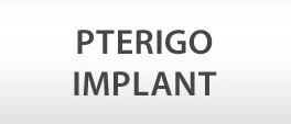 Pterigo Implant