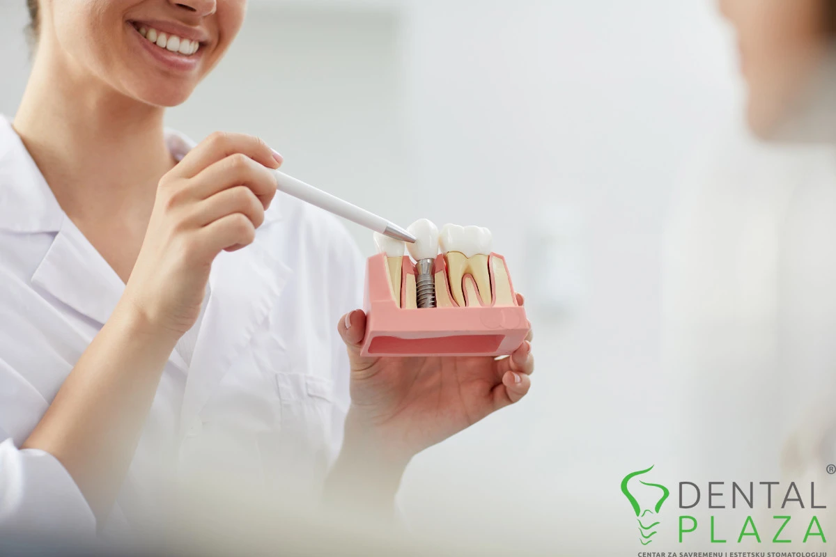 nasmejani-stomatolog-pokazuje-na-zubne-implante