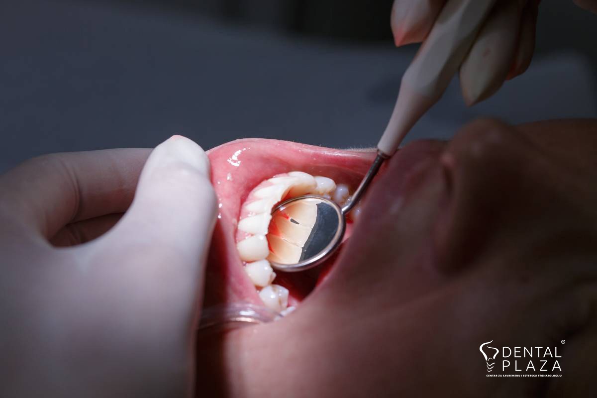 parodontologija